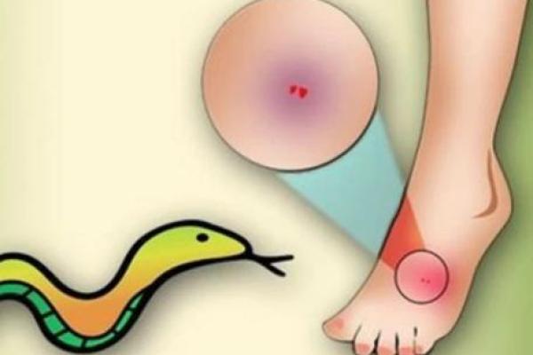 梦到被蛇咬是什么征兆 女性 梦到被蛇咬是什么征兆 女性