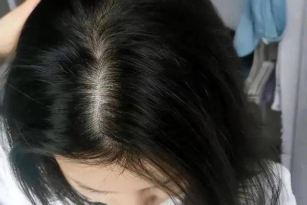 初几不能洗头发 初几不能洗头发