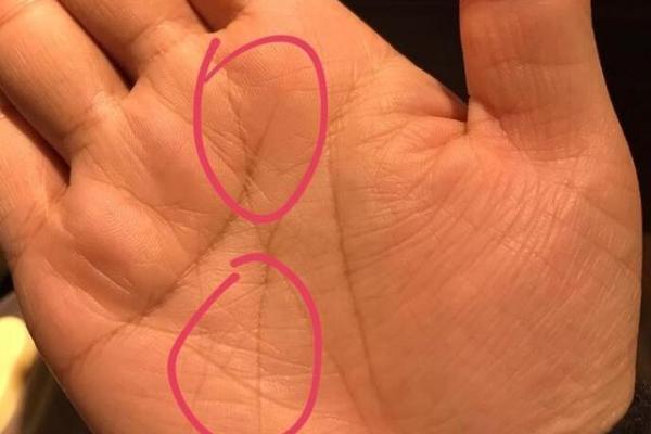 女人胳膊上的二婚线_女人二婚线最明显的征兆