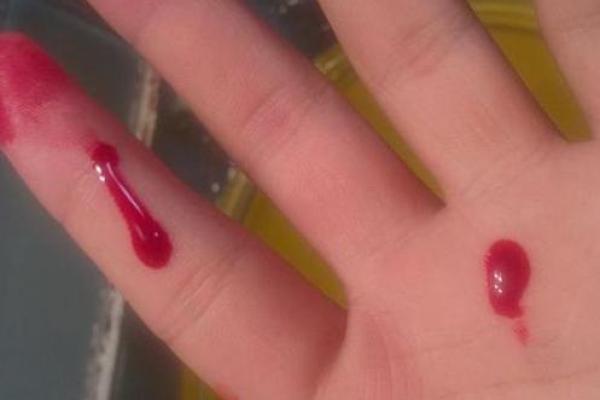 梦到血是什么预兆男人