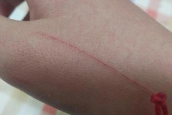 梦到被猫抓 梦到被猫抓