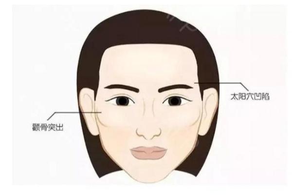 颧骨高的女人克夫吗