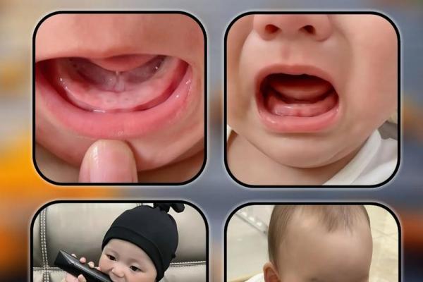 妈妈梦见孩子长牙齿什么意思 妈妈梦见孩子长牙齿什么意思