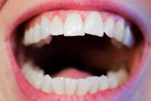 梦见剃头是什么预兆 男人 梦见剃头是什么预兆 男人