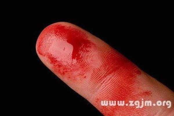 梦见被人砍 梦见被人砍