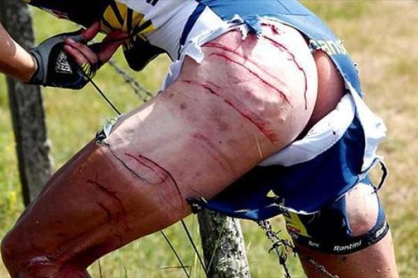 “皮开肉绽”是什么生肖动物,皮开肉绽是什么生肖动物答案解释释义落实 “皮开肉绽”是什么生肖动物,皮开肉绽是什么生肖动物答案解释释义落实